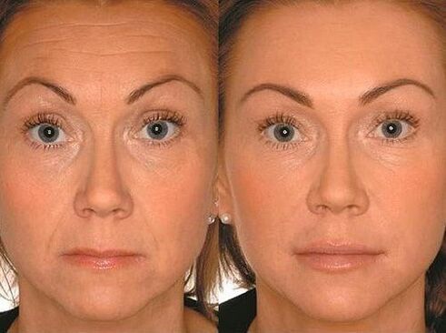 Antes e depois da terapia microcorrente