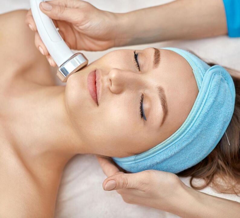 RF levantamento facial facial